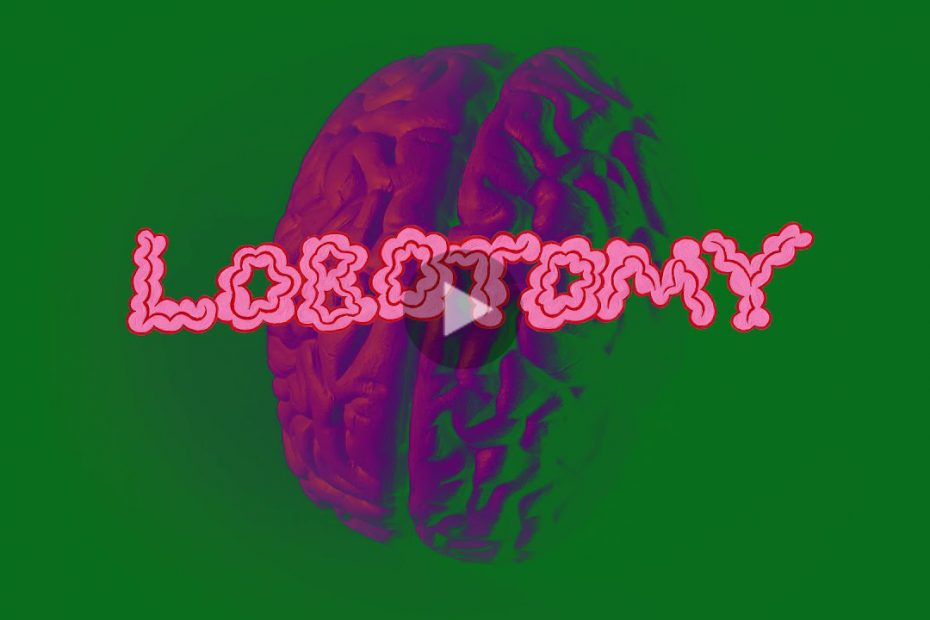 volcom lobotomy